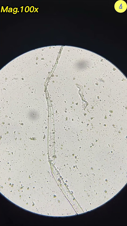 Condom Under Microscope | TULO - Microscope #shorts #underthemicroscope #condom