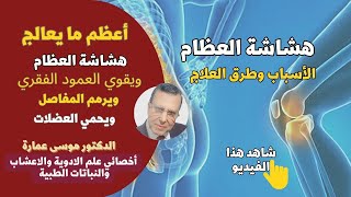 علاج هشاشة العظام وتيبس المفاصل بالغذاء | دكتور موسى عمارة أخصائي علم الأدوية والأمراض