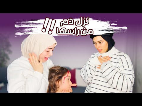 رفيقتي عصبت و ضربت بنتي على راسا