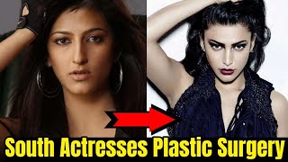 SHOCKING Plastic Surgery of South Indian Actresses BEFORE &amp; AFTER | Samantha Akkineni, Rashmika