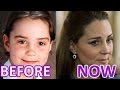 Woman and Time: KATE Middleton. BEFORE and NOW