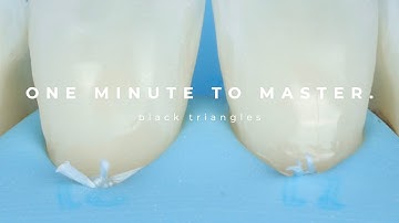 One Minute To Master - Black Triangles