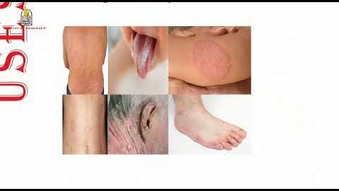 IMIDAZOLE synthesis and reactions organic chemistry group WAB1