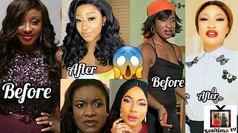 Nollywood Actresses Unbelievable Skin Transformation