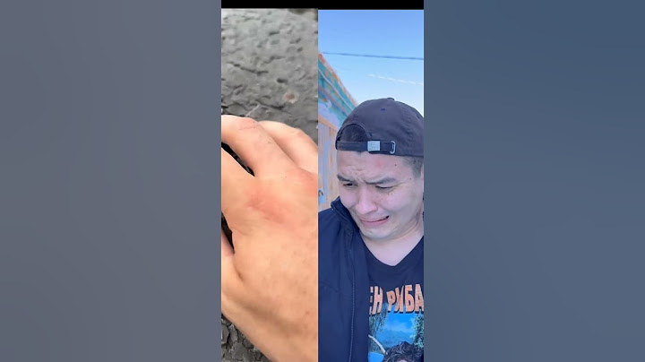Когла батя получил травму на работе🤣#батёк#видео#скечи