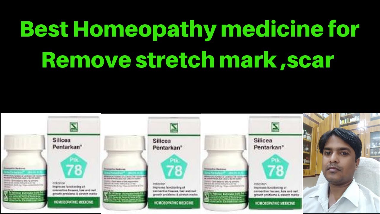 Best homeopathy medicine for stretch mark, scar silicea pentarkan