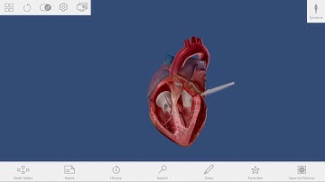 The Circulatory System: Virtual Reality Visible Body Activity with zSpace