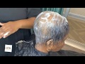 Severe Alopecia| How to hide balding | Alopecia Hair Style| Sensational Goddess Bump |