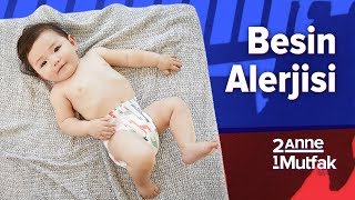 bebeklerde besin alerjisi belirtileri nelerdir bebek gelisimi ve bebek sagligi youtube