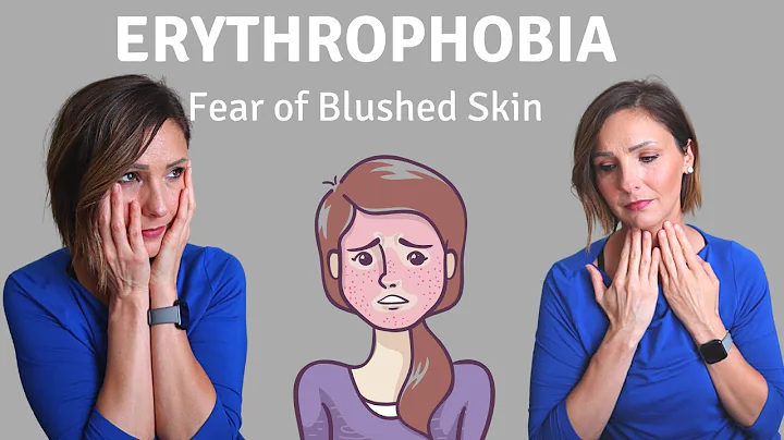 Fear of Blushed Skin - Erythrophobia