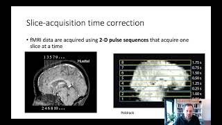 Methods_L2_5_SliceTimingCorrection