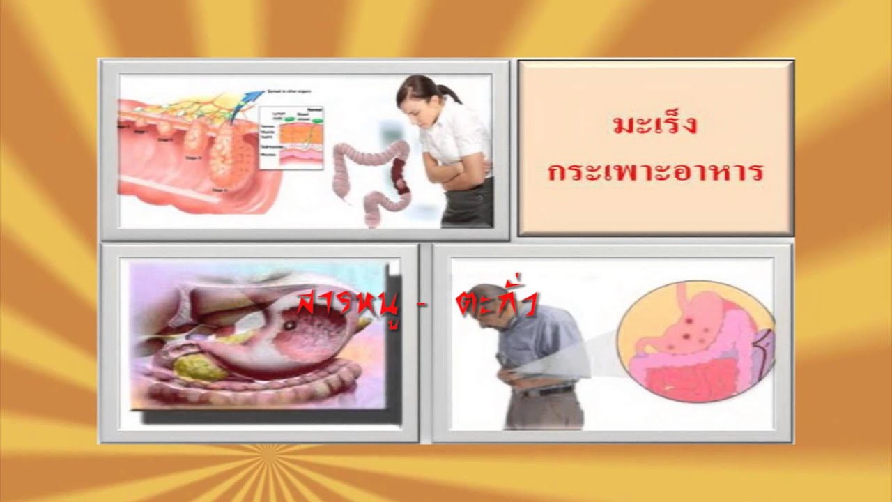 สีผสมอาหารจากธรรมชาติ | อันตราย จาก สี ผสม อาหารข้อมูลที่เกี่ยวข้องทั้งหมด