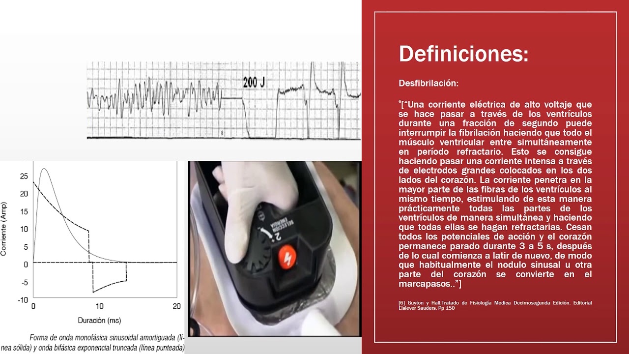 Aspectos Teoricos Para El Uso Del Desfibrilador Monofasico Y