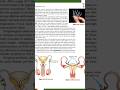 Implants, Vasectomy, tubectomy NCERT diagram #m.imp for 12th, neet #biology #Urvashi bio easy