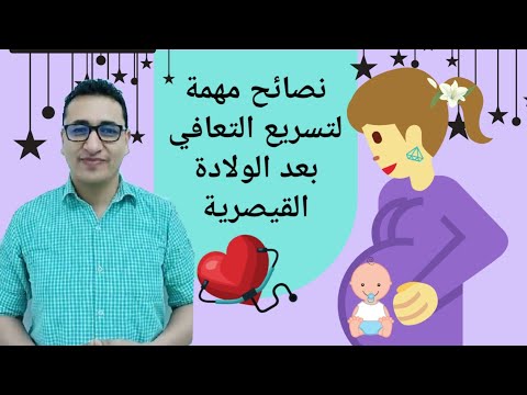 التعافي السريع بعد الولادة القيصرية نصائح للام قبل وبعد القيصرية