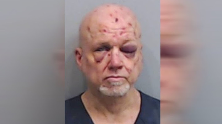 Woman uses keys to defend herself from attack