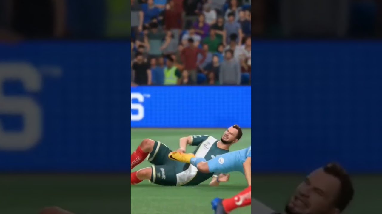 Soccer player Breaks leg BAD