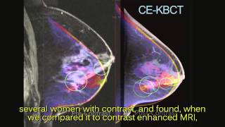 Koning Breast CT