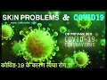 कोविड -19 और त्वचा की समस्याएं | covid-19 and skin problems|  DR PRIYANK SEN | ADITYA SKIN CLINIC