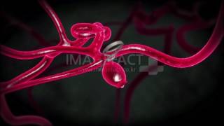 brain cerebrovascular cerebrovascular disease neurotransmitter neurohumoral transmitter