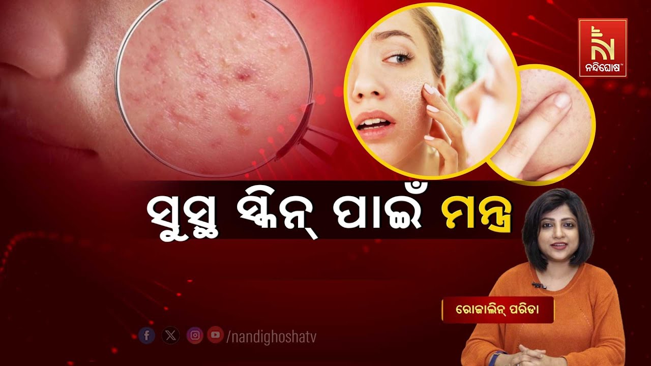 Skin Care Tips for Summer | Dr. Rojalin Parida | Swasthyasutra