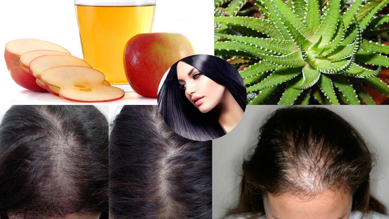 Hair Treatment At Home Grow 2 inches in 7 days Apple Cider Vinegar