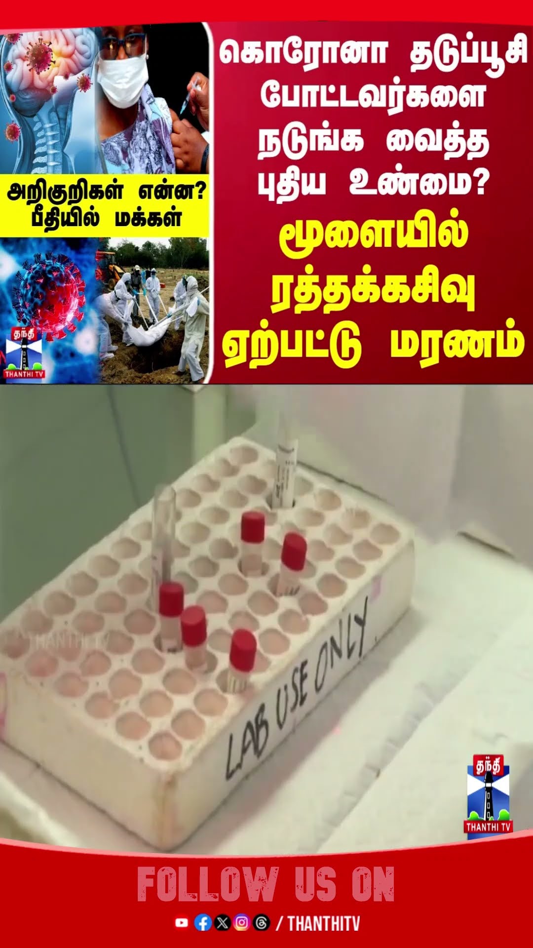 coronavaccine || coronavirus || injection || vaccine || coronanews