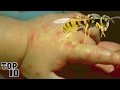 Top 10 Insects You Don’t Want To Get Stung By