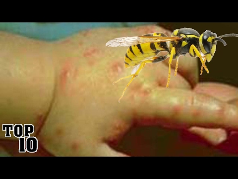 Top 10 Insects You Don’t Want To Get Stung By