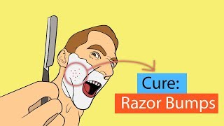 9 Fastest Ways to Get Rid of Razor Bumps