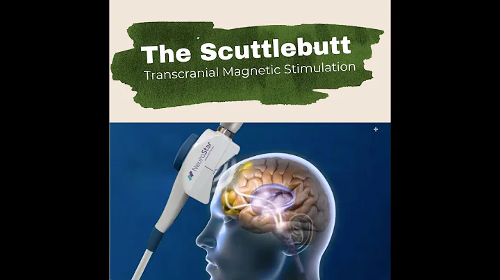 Can Transcranial Magnetic Stimulation cure PTSD? |...