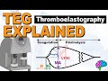 Teg explained  understanding the thromboelastography