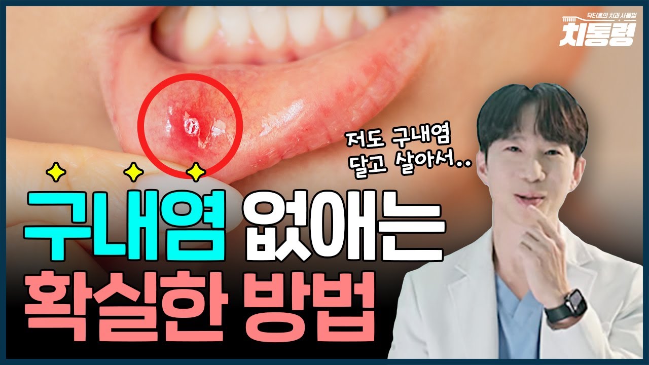 입병 빨리 낫는 법 | 구내염 자주 생기시는 분들 보세요 - YouTube
