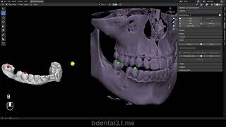 2 Bdental3 Segmentation and Alignement Tools EN
