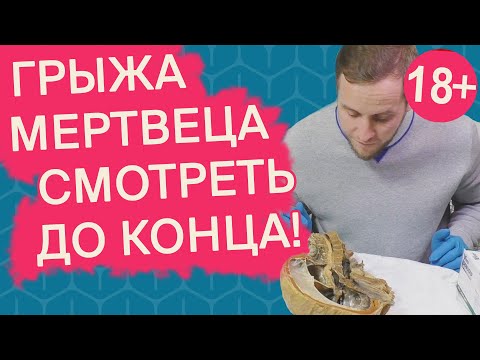 Грыжа у ТРУПА | Может ли массажист ПРОДАВИТЬ ГРЫЖУ? | Доктор Епифанов