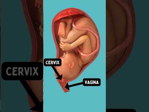 Video: Ar trebui ca dopul de mucus să fie maro?