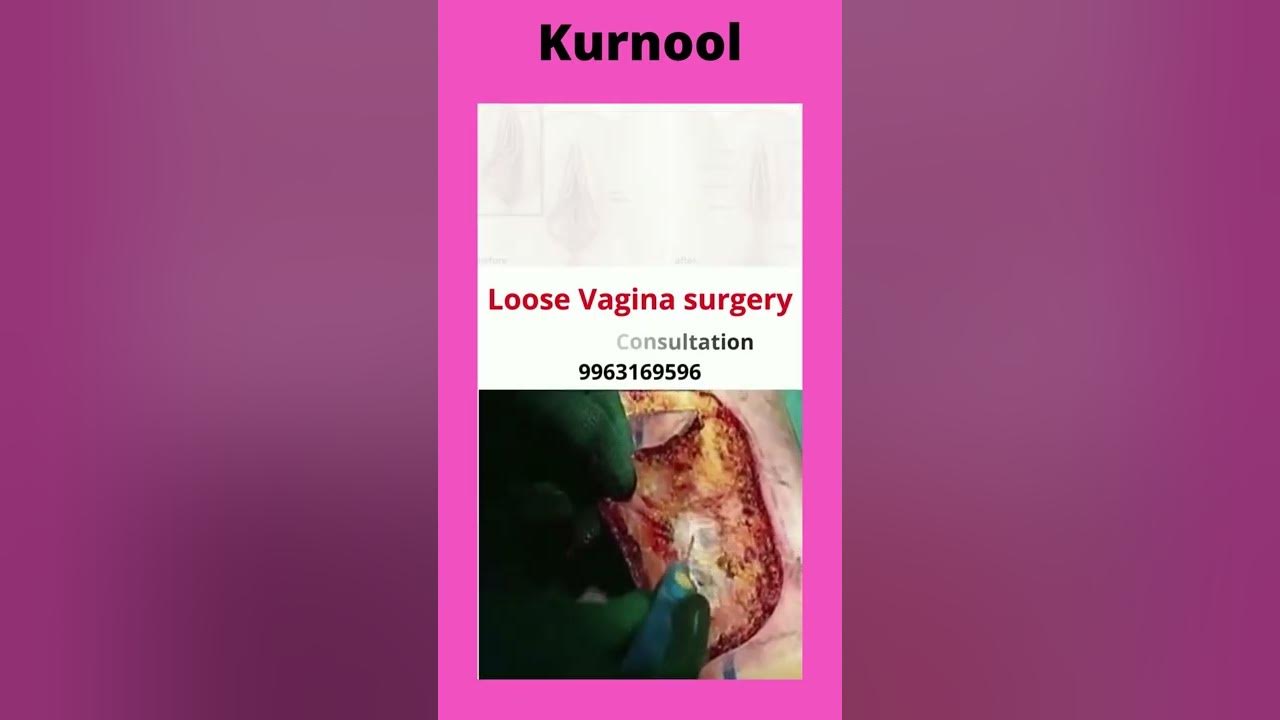 loose-vagina-surgery-cost-in-kurnool-loose-vagina-surgery-treatment