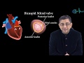 Mitral Valve Prolapse with animation (The future of Medical Education)