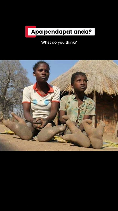 Only TWO Toes?! Mutation or Ancient Curse? 🦶🏾 Suku pelik di Afrika… dua jari kaki saja! #shorts