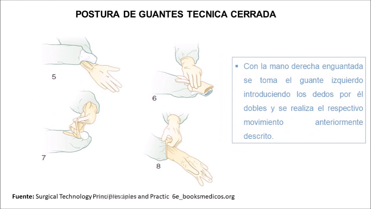 POSTURA DE GUANTES TÉCNICA CERRADA - YouTube