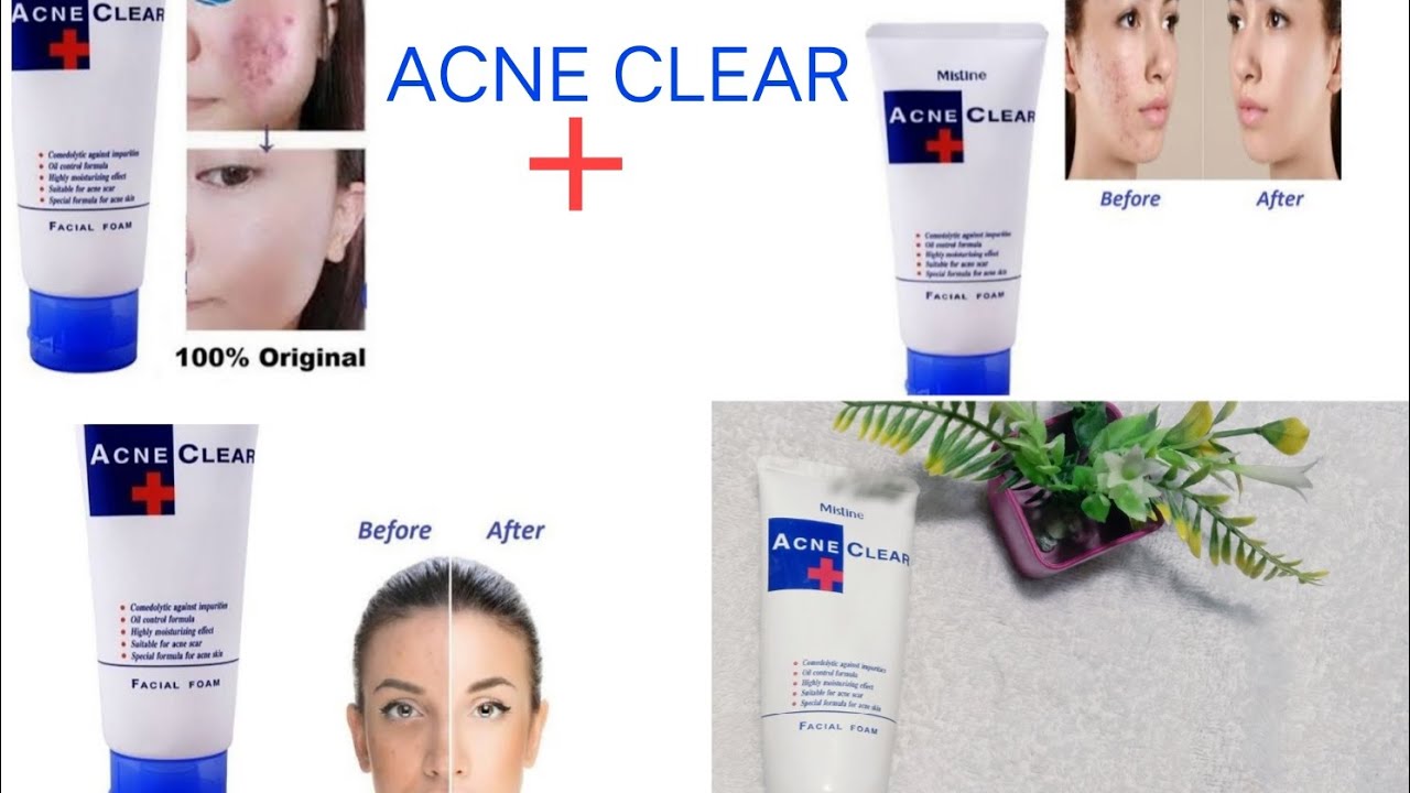 ACNE clear face wash YouTube
