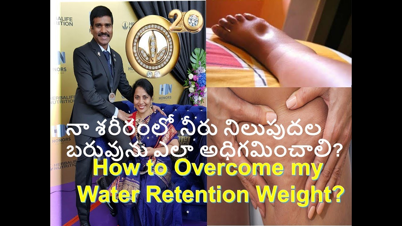 నా శరీరంలో నీరు నిలుపుదల బరువును ఎలా అధిగమించాలి? How to Overcome My Water Retention Body Weight?