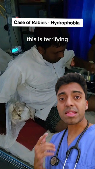 💦😱 This man is SCARED of water due to RABIES infection - Doctor Explains