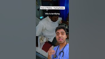 💦😱 This man is SCARED of water due to RABIES infection - Doctor Explains