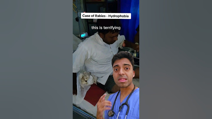 💦😱 This man is SCARED of water due to RABIES infection - Doctor Explains