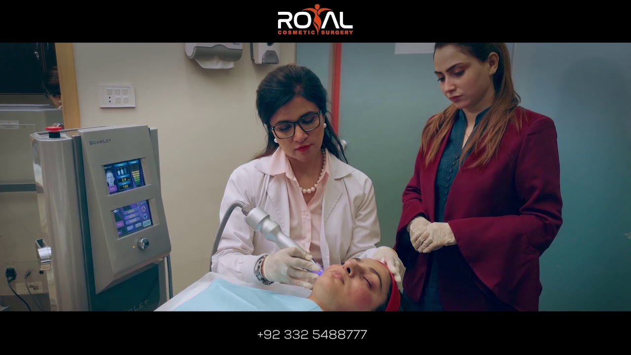 Scarlet S Laser Treatment For Acne Scar Removal in Islamabad Pakistan