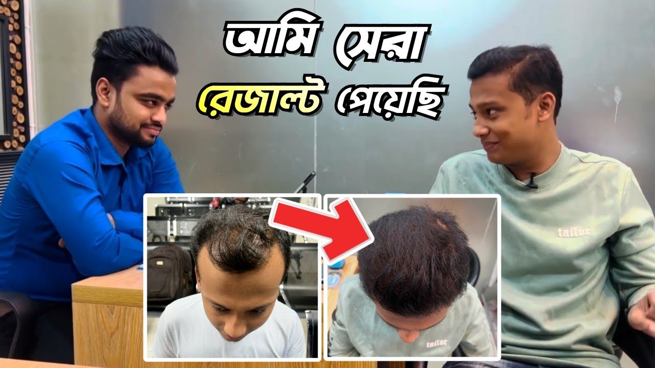 আমার রেজাল্ট এ সবাই অবাক | Best Hair Transplant Clinic In Bangladesh | Hair Transplant Result Dhaka