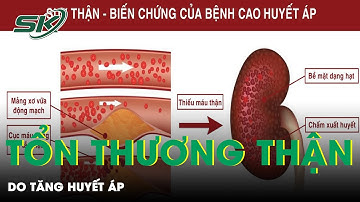 Tăng Huyết Áp Khiến Thận Bị Tổn Thương | SKĐS