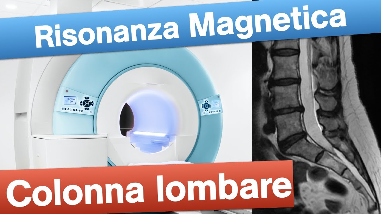 Risonanza Magnetica lombare - Quando e come eseguirla. - YouTube