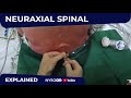 Neuraxial Spinal Anesthesia Ultrasound assisted - Regional anesthesia Crash course with Dr. Hadzic
